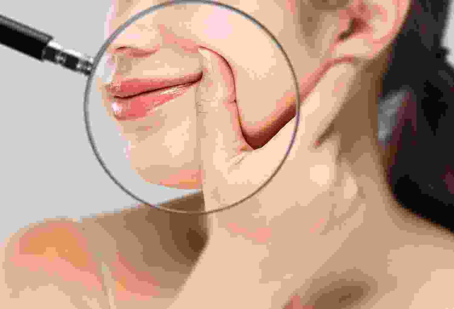 Plastic Surgery
